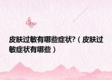 皮膚過(guò)敏有哪些癥狀?（皮膚過(guò)敏癥狀有哪些）