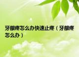 牙齦疼怎么辦快速止疼（牙齦疼怎么辦）