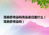 蕁麻疹傳染嗎傳染途徑是什么（蕁麻疹傳染嗎）