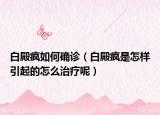 白殿瘋?cè)绾未_診（白殿瘋是怎樣引起的怎么治療呢）