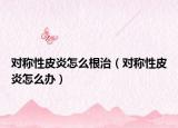 對(duì)稱性皮炎怎么根治（對(duì)稱性皮炎怎么辦）