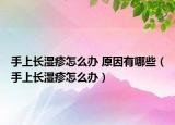 手上長(zhǎng)濕疹怎么辦 原因有哪些（手上長(zhǎng)濕疹怎么辦）