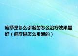 皰疹是怎么引起的怎么治療效果最好（皰疹是怎么引起的）