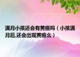 滿月小孩還會有黃疸嗎（小孩滿月后,還會出現(xiàn)黃疸么）