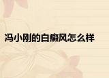 馮小剛的白癜風(fēng)怎么樣