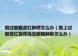 臉過敏眼皮紅腫癢怎么辦（臉上過敏發(fā)紅發(fā)癢而且眼睛腫脹怎么辦）