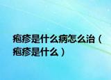 皰疹是什么病怎么治（皰疹是什么）