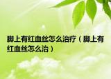 腳上有紅血絲怎么治療（腳上有紅血絲怎么治）