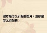 濕疹是怎么引起的圖片（濕疹是怎么引起的）