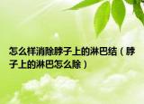 怎么樣消除脖子上的淋巴結(jié)（脖子上的淋巴怎么除）