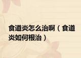 食道炎怎么治?。ㄊ车姥兹绾胃危? /></span></a>
                        <h2><a href=