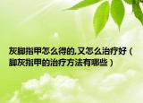 灰腳指甲怎么得的,又怎么治療好（腳灰指甲的治療方法有哪些）