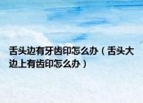 舌頭邊有牙齒印怎么辦（舌頭大邊上有齒印怎么辦）