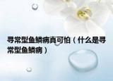 尋常型魚鱗病真可怕（什么是尋常型魚鱗病）