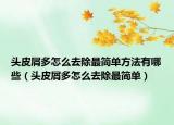 頭皮屑多怎么去除最簡(jiǎn)單方法有哪些（頭皮屑多怎么去除最簡(jiǎn)單）