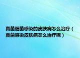 真菌細(xì)菌感染的皮膚病怎么治療（真菌感染皮膚病怎么治療呢）