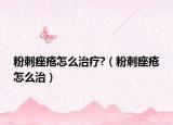 粉刺痤瘡怎么治療?（粉刺痤瘡怎么治）