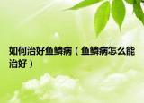 如何治好魚鱗?。~鱗病怎么能治好）