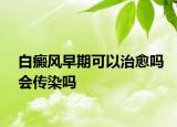 白癜風(fēng)早期可以治愈嗎會傳染嗎