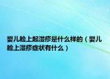 嬰兒臉上起濕疹是什么樣的（嬰兒臉上濕疹癥狀有什么）