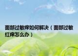面部過敏癢如何解決（面部過敏紅癢怎么辦）