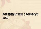 雙腎有結(jié)石嚴(yán)重嗎（雙腎結(jié)石怎么樣）