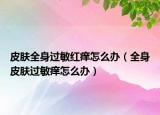 皮膚全身過(guò)敏紅癢怎么辦（全身皮膚過(guò)敏癢怎么辦）