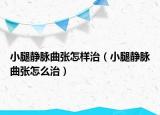 小腿靜脈曲張?jiān)鯓又危ㄐ⊥褥o脈曲張?jiān)趺粗危? /></span></a>
                        <h2><a href=