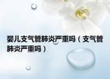嬰兒支氣管肺炎嚴(yán)重嗎（支氣管肺炎嚴(yán)重嗎）