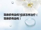 蕁麻疹傳染嗎?應(yīng)該怎樣治療（蕁麻疹傳染嗎）