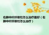 右肺中葉纖維灶怎么治療最好（右肺中葉纖維灶怎么治療）