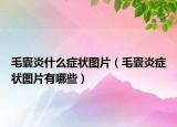 毛囊炎什么癥狀圖片（毛囊炎癥狀圖片有哪些）