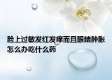 臉上過敏發(fā)紅發(fā)癢而且眼睛腫脹怎么辦吃什么藥