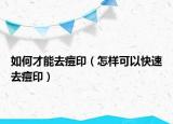 如何才能去痘?。ㄔ鯓涌梢钥焖偃ザ挥。? /></span></a>
                        <h2><a href=