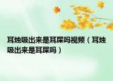 耳燭吸出來是耳屎?jiǎn)嵋曨l（耳燭吸出來是耳屎?jiǎn)幔? /></span></a>
                        <h2><a href=
