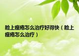 臉上痤瘡怎么治療好得快（臉上痤瘡怎么治療）