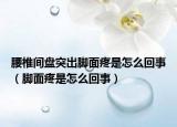 腰椎間盤突出腳面疼是怎么回事（腳面疼是怎么回事）