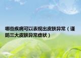 哪些疾病可以表現(xiàn)出皮膚異常（謹(jǐn)防三大皮膚異常癥狀）