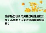 濕疹是嬰幼兒常見的過敏性皮膚炎癥（兒童患上皮炎濕疹都有哪些因素）