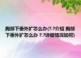 胸部下垂外擴(kuò)怎么辦(?.?介紹 胸部下垂外擴(kuò)怎么辦 ?.?詳細(xì)情況如何)