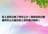 臉上皮膚過敏了癢怎么辦（面部皮膚過敏瘙癢怎么辦最近臉上很容易過敏的）
