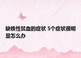 缺鐵性貧血的癥狀 5個癥狀很明顯怎么辦