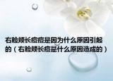 右臉頰長(zhǎng)痘痘是因?yàn)槭裁丛蛞鸬模ㄓ夷橆a長(zhǎng)痘是什么原因造成的）