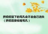 擠痘痘留下的毛孔會(huì)不會(huì)自己消失（擠痘后要收縮毛孔）