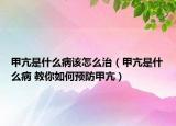 甲亢是什么病該怎么治（甲亢是什么病 教你如何預(yù)防甲亢）