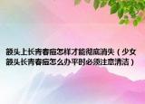 額頭上長青春痘怎樣才能徹底消失（少女額頭長青春痘怎么辦平時必須注意清潔）