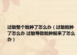 過(guò)敏整個(gè)臉腫了怎么辦（過(guò)敏臉腫了怎么辦 過(guò)敏導(dǎo)致臉腫起來(lái)了怎么辦）