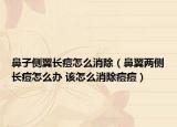 鼻子側(cè)翼長(zhǎng)痘怎么消除（鼻翼兩側(cè)長(zhǎng)痘怎么辦 該怎么消除痘痘）