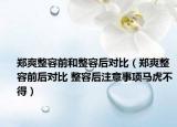 鄭爽整容前和整容后對(duì)比（鄭爽整容前后對(duì)比 整容后注意事項(xiàng)馬虎不得）