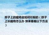 脖子上的痤瘡是如何引起的（脖子上長(zhǎng)痤瘡怎么辦 快來(lái)看看以下方法）